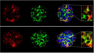 IL15-expressing neurospheres (from Gomez-Nicola et al., Mol Biol Cell 2011)     
